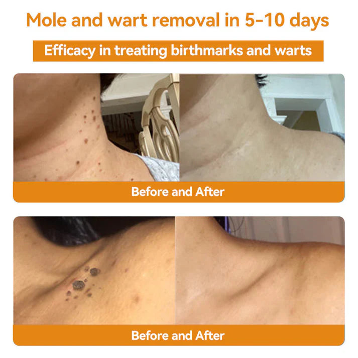 π΅οΈππ’ππππ’β’ Bee Venom Skin Treatment Cream
