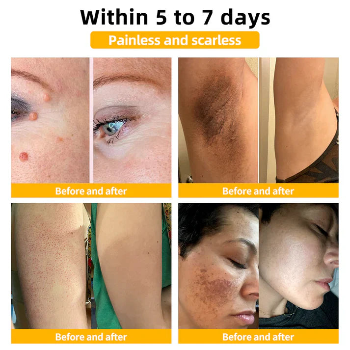 π΅οΈππ’ππππ’β’ Bee Venom Skin Treatment Cream