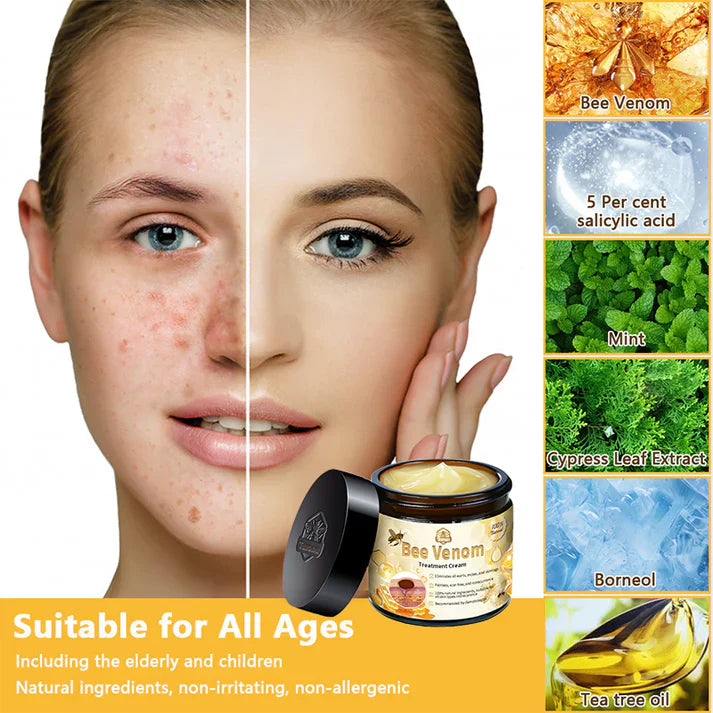 π΅οΈππ’ππππ’β’ Bee Venom Skin Treatment Cream