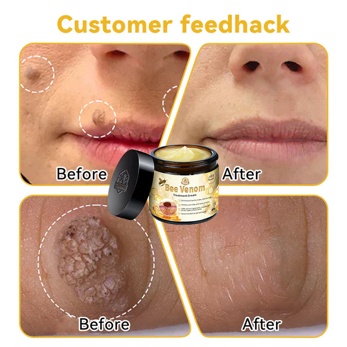 π΅οΈππ’ππππ’β’ Bee Venom Skin Treatment Cream