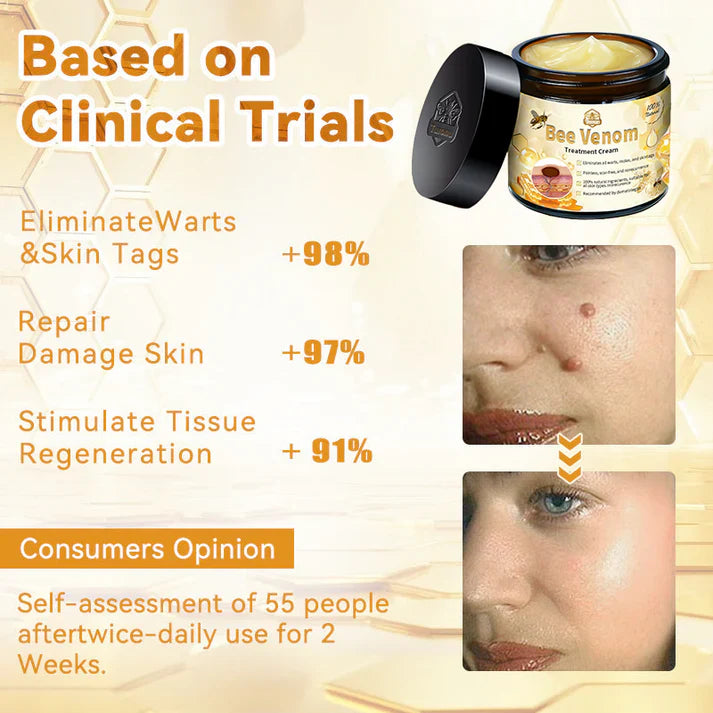 π΅οΈππ’ππππ’β’ Bee Venom Skin Treatment Cream